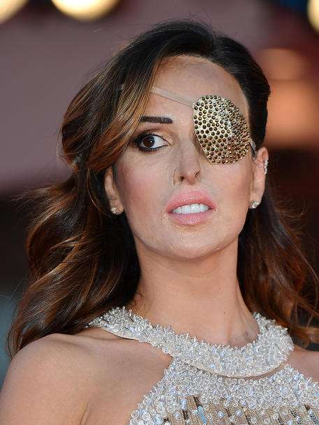 Gessica Notaro. Violenza contro le donne, simbolo del 25 novembre e impegno collettivo per prevenzione e rispetto
